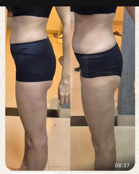 Foto de antes e depois de uma aluna da Mari